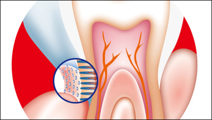 Vector interno dental
